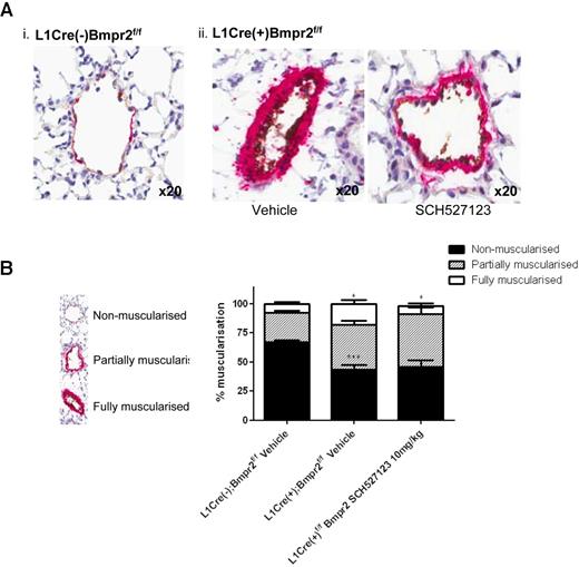 Figure 4. Inhibition of CXCR1/2 reduces muscularization and leukocyte infiltration into lungs of L1Cre(+)Bmpr2f/f mice. The left lung from L1Cre(−)Bmpr2f/f (Ai) and L1Cre(+)Bmpr2f/f mice (Aii) treated with vehicle or SCH527123 was inflated with 1% (volume/volume) formalin, processed for histologic assessment, and then stained with anti-VWF and anti–α-SMA. The extent of α-SMA staining as a measure of pulmonary artery muscularization was assessed in 100 small vessels (30-70 μm) per animal and assigned as nonmuscularized (no α-SMA staining), partially muscularized, or fully muscularized (thick unbroken wall of smooth muscle), and the percentage distribution of each calculated per group (B). Data are the mean ± SEM for a minimum of 8 animals per group. *P < .05, ***P < .001 compared with L1Cre(−)Bmpr2f/f mice by Dunnett test. Slides were mounted using VECTORSHIELD (Vector Laboratories) and viewed using a 20× objective lens. Images were captured using a DMLB microscope and digital camera. Digital image acquisition was performed using IM50 Version 4.0 imaging software (Leica Microsystems) and digital image slide viewing using ImageScope software (Aperio Technologies).