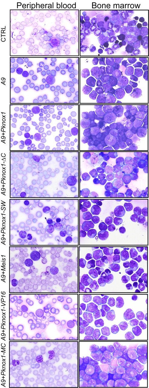 Figure 4. Morphologic characterization of leukemias. Representative samples of Wright-stained peripheral blood smears (right column) and bone marrow cytospins (left column). Original magnification ×100. Genotypes of leukemias are shown on the left.
