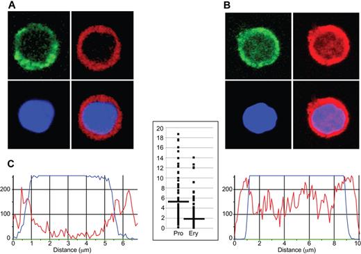 Figure 3. Immunohistochemical analysis of EKLF in progenitor cell and erythroblast nuclei. Day E13.5 fetal liver cells from HA-tagged EKLF mice were FACS sorted into populations of erythroid progenitor cells (A; CD71+ TER119−) and erythroblasts (B; CD71+ TER119+). The cells were fixed and stained with DAPI (DNA) and an AlexaFluor-594–conjugated anti-HA antibody to identify EKLF in individual cells. (A-B) The top left images represent CD71 staining (green); top right images, EKLF (red); bottom left images, DNA (blue); and bottom right images, the EKLF and DNA images merged. Magenta represents nuclear EKLF. (C) Quantification of EKLF distribution in individual nuclei. The blue tracings represent the relative amount of DAPI signal, and the red tracings represent the relative amount of AlexaFluor-594 signal (EKLF) across an individual progenitor cell (left) or erythroblast (right). The y-axis on the graph in the center represents the ratio of the EKLF-to-DNA signal in the peripheral 20% of the nucleus (10% each side) to the ratio of the EKLF-to-DNA signal in the central 20% of the nucleus for progenitor cells (Pro) and erythroblasts (Ery). A total of 8 peripheral and 8 central data points from 30 nuclei were analyzed for a total of 240 points in each cell type. Images were acquired at room temperature using a Zeiss LSM 510 NLO Meta system mounted on a Zeiss Axiovert 200M microscope with an oil immersion Plan-Apochromat 63×/1.4 DIC objective lens. Excitation wavelengths of 488 nm (3%), 561 nm (6%), and 770 nm (3%) were used to detect anti-CD71 FITC, anti-HA–AlexaFluor-594, and DAPI, respectively. Fluorescent emissions were collected in a BP 500- to 550-nm IR blocked filter, BP 575- to 615-nm IR blocked filter, BP 641- to 705-nm custom filter, and a BP 390- to 465-nm IR blocked filter, respectively. All pinholes were set with a range from 1.11 to 1.33 Airy units, corresponding to an optical slice of 1.0 μm (excluding the DAPI channel where a multiphoton laser was used). All confocal images were of frame size 512 × 512 pixels, scan zoom of 3, and line averaged 8 times. Confocal images were postprocessed using MediaCybernetics' Image-Pro Plus Version 7.0 software package. Each image was processed using a built-in Line Profile tool. A line was drawn through the middle of each cell to determine the density of red (EKLF) and blue (DAPI) signals in the middle 20% of the nucleus and on both edges (10% each side).