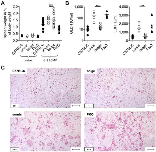Figure 3. Souris mice display histopathologic features of HLH after LCMV infection. BeigeJ, souris, PKO, and wild-type C57BL/6 mice were infected with 200 pfu LCMV intravenously. (A) Spleen weight in percentage of body weight and (B) serum levels of liver enzymes on day 12 after LCMV infection. Pooled data from at least 2 independent experiments with 3 to 5 mice per group. n.s. indicates not significant (P > .05). ***P < .001. (C) Representative pictures of liver sections stained with anti-F4/80 (original magnification × 10). Lower left inset: A semiquantitative analysis of hemophagocytosis by macrophages as assessed in 10 high power visual fields (40×) per mouse. (+) indicates rare; +, few; and +++, very frequent. Scale bars represent 100 μm.