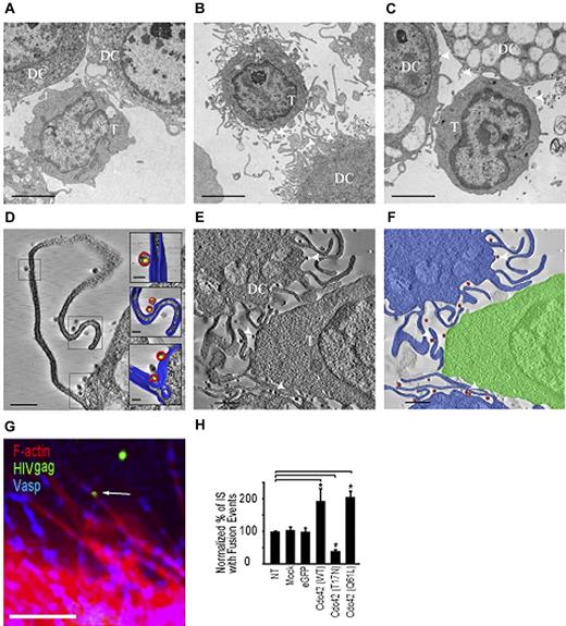 Figure 3. HIV-1 is localized on membrane extensions at the DC-CD4+ T cell infectious synapse. Transmission electron microscopy of contacts between immature DC and T cells. (A-C) Projection electron microscopy images of a 100-nm-thick section from fixed, plastic-embedded cocultures of T cells and immature DCs either in the absence of added HIV-1 (A), after exposure to HIV-1 for 1 hour (B), and after treatment with the cdc42 inhibitor secramine A, followed by exposure to HIV-1 (C). (D-E) A 5-nm tomographic slice from a 3D image of a 175-nm-thick section prepared from fixed, plastic-embedded cocultures of T cells and DCs exposed to HIV-1 (as in B) showing viruses riding on the membrane extensions from the DCs. (F) Schematic rendering of tomographic slice in panel E highlighting contact between T cells (green) and immature DCs (blue) in the presence of HIV (red). Scale bars, original magnifications: (A-C) 2 μm; (D-E) 1 μm. (G) Representative image of membrane extensions on DCs with HIV-1 near extension tips. Bar represents 1 μm. (H) Quantification of fused HIV-1 viral particles in target CD4+ T lymphocytes after nucleofection of Cdc42 mutants in DCs. All values are normalized to a 100% value assigned to the nontreated condition. Arrows indicate HIV-1 viral particles on membrane extensions on DCs. Data are mean ±SD of 3 independent experiments. *P < .05 (Student t test). Bonferroni test with an α-error value of 5% has been applied to all panels with multiple comparisons.