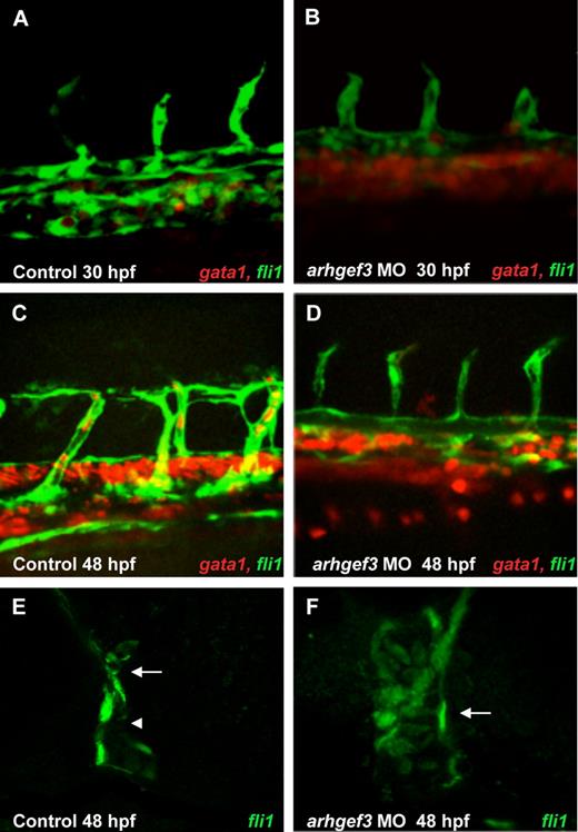 Figure 3. Expression analysis of endothelial marker fli1a and erythroid marker gata1 in double transgenic embryos Tg(fli1a:EGFP) Tg(gata1:DsRed) shows that vascular development is impaired in arhgef3-depleted embryos. At 30 and 48 hpf arhgef3 MO-injected embryos (B,D) showed a poor segregation of artery and vein compared with control embryos (A,C). Furthermore, arhgef3-depleted embryos exhibited an accumulation of gata1+ cells in the subaortic region (B,D). By 48 hpf, all gata1+ cells from the subaortic space of control embryos have entered the circulation (C), whereas in arhgef3 MO-injected ones a reduced number of gata1+ cells were observed in the circulation (D). (E-F) Transverse agarose sections (200-μm thick) of Tg(fli1a:EGFP) control embryos at 48 hpf show 2 distinct lumenized vessels, artery (E arrow) and vein (E arrowhead), whereas lumen formation of arhgef3 MO-injected ones is perturbed and axial vessels form a single tube (F arrow).