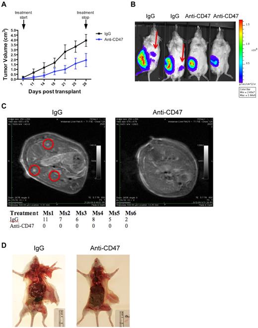 Figure 2. A blocking anti-CD47 antibody inhibits formation of extranodal disease in Raji-engrafted mice. (A) Luciferase-labeled Raji cells were transplanted subcutaneously into the right flank of NSG mice. One week later, mice were administered daily therapy with 200 μg anti-CD47 antibody or mouse IgG control. Tumor volume was measured until end of treatment (posttransplantation day 28). Anti-CD47 antibody treatment reduced tumor volume compared with IgG control. ***P < .0001 (2-way ANOVA). (B) These mice were analyzed in parallel for the presence of luciferase-positive disease to assess tumor dissemination. Spread of disease to secondary sites (red arrows) was detected in IgG control-treated mice 3 weeks after transplantation, whereas no dissemination was observed in anti-CD47 antibody-treated mice. Representative mice are shown (n = 6 per treatment group). (C) Analysis of tumor lesions was performed by MRI at 3 weeks after transplantation, demonstrating tumor nodules (red circles) in controls, but not in mice treated with anti-CD47 antibody. The table reports the number of tumor nodules observed for each mouse, as assessed by a blinded-clinically trained radiation oncologist. (D) Mice were then killed and assessed for gross lesions, which demonstrated diffuse liver involvement in representative mice treated with control IgG, but not with anti-CD47 antibody.