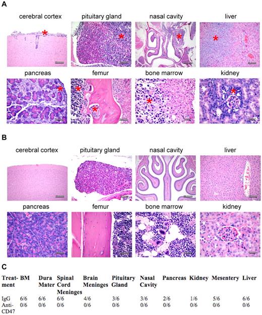 Figure 3. A blocking anti-CD47 antibody inhibits dissemination of Raji cells to multiple major organs. Mice engrafted subcutaneously with Raji cells and treated with either IgG control (A) or anti-CD47 antibody (B; from Figure 2) were killed after 1 month, and major organs were analyzed for dissemination of human lymphoma by H&E staining. Lymphoma dissemination was observed in several major organs of IgG control-treated mice as demonstrated by invasion of monomorphic lymphoma cells and disruption of normal cellular architecture. (A) Red asterisks indicate areas of lymphoma invasion. (B) No evidence of human lymphoma was observed in anti-CD47 antibody-treated mice. (C) Human lymphoma organ invasion was assessed by a blinded pathologist. The number of mice with disseminated lymphoma in each organ is indicated.