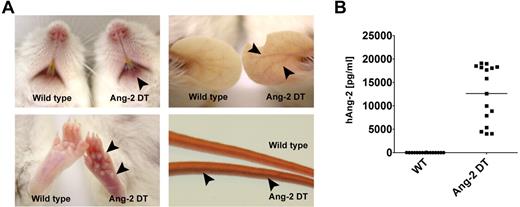 Figure 2. Macroscopic phenotype of Ang-2 transgenic mice. Ang-2 DT mice with high Ang-2 protein level in the serum display signs of skin erythema starting after 6 months of transgene expression (arrowheads). (A) Arrowheads in lower right panel point at dilated tail vein of an Ang-2 DT mouse. (B) Human Ang-2 serum levels secreted in the peripheral blood of Ang-2 DT mice after doxycycline depletion were determined by ELISA.