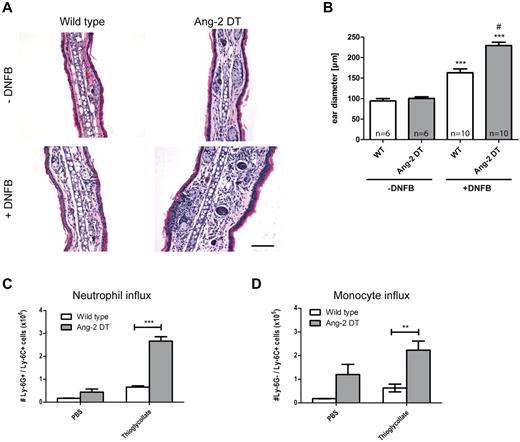 Figure 3. Ang-2 augments DTH and peritonitis in transgenic mice. After induction of DTH, leukocyte infiltration was measured in DNFB-treated ears (A). Severely increased ear swelling was evident in Ang-2 DT as shown by H&E staining (A). Quantification revealed significantly increased ear diameters in Ang-2 DT compared with WT mice (B). ***P < .005, compared with untreated ears. #P < .001, compared with treated WT ears. In a model of thioglycollate-induced peritonitis, peritoneal neutrophils were identified according to the expression of Ly-6G and Ly-6C and counted by FACS (C). After thioglycollate challenge, transgenic animals showed significantly increased numbers of myeloid cells in the peritoneal cavity (C-D). Among those, neutrophils (Ly-6G+/Ly-6C+) and monocytes (Ly-6G−/Ly-6C+) were prominent (C-D). Data are mean ± SEM; n = 4. *P < .05. ***P < .005.