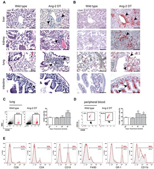 Figure 4. Leukocyte infiltration in multiple organs. Large infiltrates of hematopoietic cells were detected in liver, kidney, lung, and intestine sections of Ang-2 transgenic animals after 6 months of Ang-2 expression, as shown in H&E staining (A) and anti-CD45 immunohistochemistry (B). FACS analysis of dissociated lung samples showed a time-dependent increase of CD45+ leukocytes on prolonged Ang-2 expression (C), which was accompanied by a gain of CD45+ CD11b+ myeloid cells in the peripheral blood (D). Further analysis of leukocyte subsets of either WT (gray filled lines) or Ang-2 DT mice (red lines) showed a shift toward the myeloid lineage in the peripheral blood of transgenic mice at the expense of lymphocytes (E). Data are mean ± SEM. (C) n = 4. (D) n = 5. Scale bar represents 100 μm. *P < .05. **P < .01. ***P < .005.