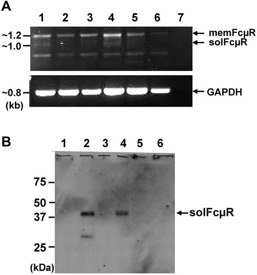 Figure 4. Cellular origin of the soluble FcμR. (A) RT-PCR analysis of FCMR transcripts. The CD5+/CD19+ CLL B (lanes 1 and 4), CD5−/CD19+ non-CLL B (lanes 2 and 5), and CD5+/CD19− T cells (lanes 3 and 6) in patients with MT-CLL (lanes 1-3) and UM-CLL (lanes 4-6) were enriched from PBMC by cell sorting. Total RNAs were extracted from the sorted cells and converted to first-strand cDNA before PCR amplification using a set of primers corresponding to the FCMR or GAPDH cDNA. An aliquot of the amplified FCMR (top panel) and GAPDH (bottom panel) products was electrophoresed on 1% agarose and stained with ethidium bromide. Lane 7 is a PCR control without a first-strand cDNA template. (B) Western blot analysis of soluble FcμR in culture supernatants. The above-sorted cells were cultured at 106 cells/mL for 7 days, and the culture supernatants from CLL B (lanes 1 and 2), non-CLL B (lanes 3 and 4), and T cells (lanes 5 and 6) were analyzed by Western blot as described in “Methods.”