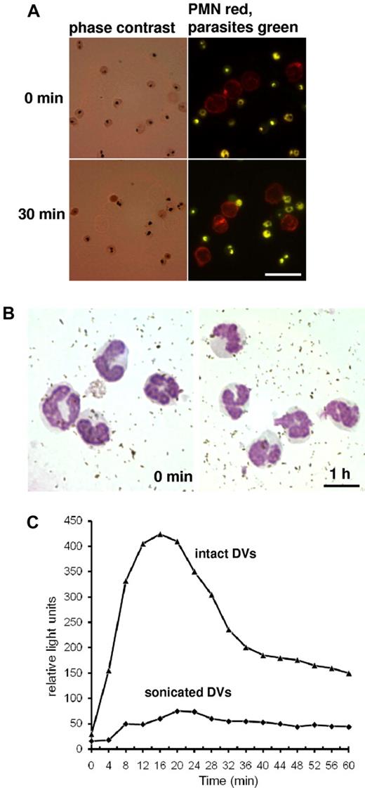 Figure 4. PMNs do not phagocytose late-stage pRBCs or hemozoin in nonimmune serum. (A) pRBCs were stained with BCECF-AM, a nonfluorescent acetoxymethylester that is enzymatically hydrolyzed to fluorescent BCECF, to visualize parasites and intracellular DVs, and incubated with PE-labeled PMNs in active human serum. No erythrophagocytosis could be discerned after 30 minutes. Scale bar indicates 20 μm. (B) DVs were disrupted by sonication and hemozoin was isolated from a Percoll gradient and incubated with PMNs in active serum. No evidence for phagocytic uptake and no appearance of cells with characteristic malaria pigment could be discerned in Giemsa-stained smears. Scale bar indicates 10 μm. (C) Luminol-based chemiluminescence assay were performed in PMNs and active serum upon incubation with intact DVs or with sonicated DVs (hemozoin). Representative results are shown from 1 of 3 similar experiments.