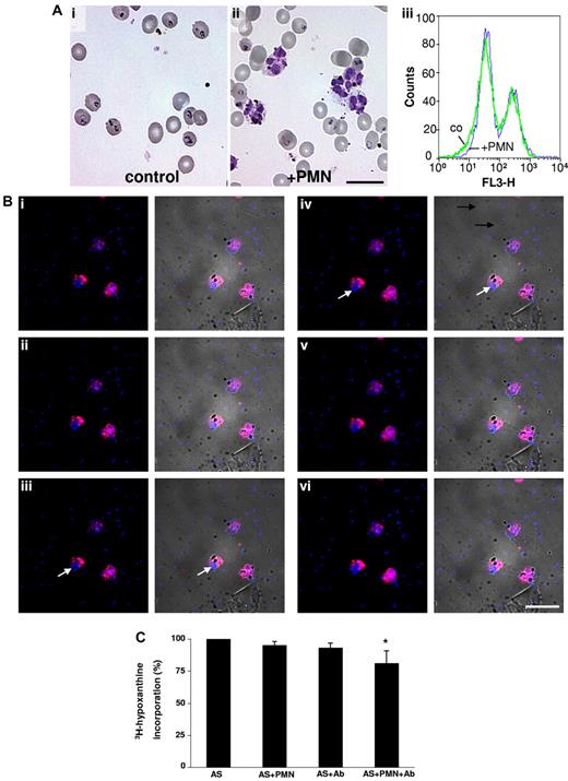 Figure 5. Lack of protective effect of PMNs on merozoite reinvasion. (A) Late-stage pRBCs were allowed to rupture and new infection was allowed to proceed in active human serum in the absence (i) or presence (ii) of PMNs. Twenty-four hours later, ring forms could be seen microscopically in both cases. Infected erythrocytes were detected by fluorescent staining of parasite DNA with hydroethidium-bromide (iii). Flow cytometric analyses revealed identical infection rates in the presence and absence of PMNs (right peaks: fluorescing infected cells; left peaks: nonfluorescing, noninfected cells). (B) Detection of merozoite phagocytosis mediated by Abs against P falciparum. The experiment shown in Figure 3B was repeated in the presence of 1 mg/mL of IgG isolated from a pool of 5 sera containing high-titered Abs against P falciparum. Stacked images (i-vi, top to bottom) now revealed that merozoites (blue) had been phagocytosed alongside with the DVs. Left rows: fluorescence; right rows: merged fluorescence and phase-contrast images. Arrows: phagocytosed merozoites colocalizing with DVs in the central plane (iii-iv) of a cell. Similar results were obtained with IgG from 5 individual sera with high-titered Abs against P falciparum. Scale bar indicates 20 μm. (C) Paucity of protective effects of PMNs and specific Abs upon parasite reinvasion. The 3H-hypoxanthine DNA-incorporation assay was used and values obtained in active serum alone were defined as 100%. Results obtained with 5 high-titered Abs are shown. 3H-hypoxanthine incorporation was assessed in active serum (AS) in the presence of either PMNs or IgG (Ab) or in the presence of PMNs and IgG. A small but significant reduction in 3H-hypoxanthine incorporation was observed in the presence of Abs plus PMNs compared with the control (n = 5; *P < .001).