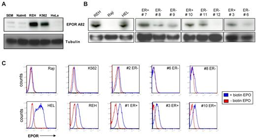 Figure 1. Association of functional EPOR expression with ETV6-RUNX1+ leukemic cell lines and patient samples. (A-B) Western blot analysis of EPOR expression using Amgen antibody A82 in different ALL cell lines and CD19+ cells isolated from patients diagnosed with ALL. K562 and HeLa cell lines were used as controls for low and negative expression of EPOR, respectively, and HEL cells for high expression. As a direct comparison with REH cells, the SEM, Nalm6, and Raji cell lines were used as pre-B cell lymphoid ETV6-RUNX1-negative cell lines. ETV6-RUNX1-positive and -negative patients are designated ER+ and ER−, respectively. (C) Functional EPOR is ectopically expressed on the cell surface of CD19+ cells isolated from ETV6-RUNX1+ pre-B ALL patients (ER+) and leukemic cell lines but not ETV6-RUNX1-negative cases (ER−). Washed cell lines and CD19+ sorted patient cells were incubated with biotinylated EPO that binds to the EPOR. Avidin-fluorescein was added and the amount of EPO measured as the increase in fluorescence analyzed by FACS compared with controls (see also supplemental Figure 1).