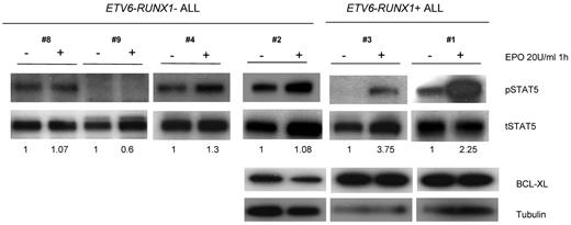 Figure 7. EPO triggers STAT5 signaling in human ETV6-RUNX1+ ALL patient samples. CD19+ cells were isolated from ALL patients, grown in RPMI medium with or without EPO 20 U/mL for 1 hour, and lysates were analyzed by Western blot for STAT5 phosphorylation and BCL-XL expression. Only in ETV6-RUNX1+ patients with higher expression of EPOR was its ligand EPO able to trigger STAT5 signaling. BCL-XL expression was always higher in ETV6-RUNX1+ samples, although there was no difference in the presence or absence of EPO.