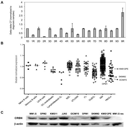 Figure 5. Low CRBN expression is common in lenalidomide refractory patients. (A) Nine MM patients, whose pretreatment and post-treatment samples were available, were analyzed by real-time PCR for the expression of CRBN in MM cells collected at both diagnosis (D) and relapse (R) stages. The data for each sample represent the mean values of 4 independent experiments (mean ± SD). (B) An analysis of CRBN expression across different differentiation stages of normal B cells and a variety of B-cell tumors, including marginal zone lymphoma (MZL, n = 86), lymphoplasmacytic lymphoma/Waldenström macroglobulinemia (LPL/WM, n = 21), follicular lymphoma (FL, n = 38), diffuse large B-cell lymphoma (DLBCL, n = 73), MM (n = 238), and HMCLs (n = 60), shows a similar expression level across entities without low expression outliers. Arrows indicate the CRBN expression level in 4 HMCLs that show resistance to lenalidomide (OCIMY5, OPM1, SKMM2, and KMS12 PE). (C) The low CRBN gene expression level found in OCIMY5 and OPM1 was correlated with low protein expression level.