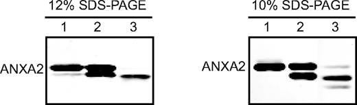 Figure 3. Expression of the truncated form of ANXA2. A total of 10 μg of A549 cell extract (lane 1), 200 ng of plasmin proteolyzed, N-terminal truncated ANXA2 (Ala-28–Asp-338, lane 2), or 10 μg of cell extract from BL21 cells expressing ANXA2 (Ser-1–Lys-307, lane 3) was subjected to 10% or 12% SDS-PAGE as indicated. Proteins were transferred onto nitrocellulose membrane and analyzed by Western blotting with the antibodies indicated. The data show that the WT ANXA2 (Ser-1–Asp-338) is easily resolved from the putative plasminogen-binding, C-terminal truncated ANXA2 (Ser-1–Lys-307).