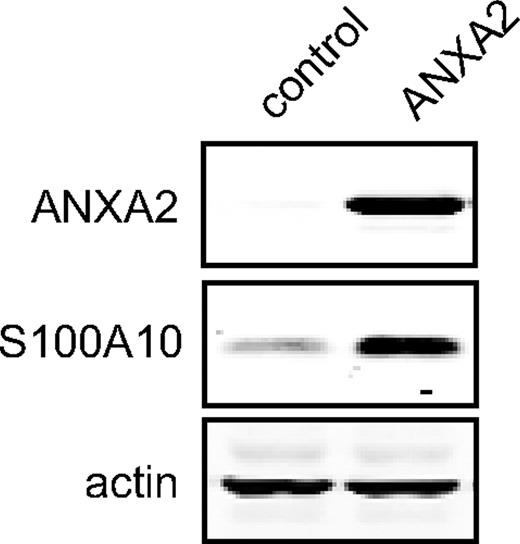 Figure 4. Overexpression of ANXA2 in 293T cells up-regulates S100A10 expression. The 293T cells were transfected with either pcDNA3 empty vector (lane 1, control) or pANXA2 vector (lane 2) and incubated at 37°C, 5% CO2 for 72 hours. A total of 20 μg of each protein lysate was subjected to SDS-PAGE, followed by Western blotting with the antibodies indicated.