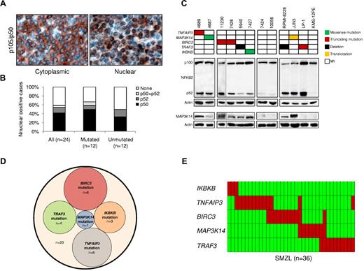 Figure 1. The NF-κB pathway is activated and frequently targeted by genetic lesions in SMZLs. (A) Immunohistochemical staining of SMZL biopsy samples with anti-NFKB1 (p50) antibody. Nuclear localization of NF-κB denotes active signaling as opposed to inactive cytoplasmic localization. Original magnification ×400. (B) Prevalence of constitutive NF-κB activation scored by immunohistochemistry in SMZLs overall and according to mutation status of NF-κB genes. (C) Western blot analysis showing NFKB2 processing and MAP3K14 expression in purified primary tumor cells from 8 SMZL cases carrying wild-type (Wt) or aberrant NF-κB genes. Case 11230 was run in a different gel using the same conditions, as indicated by the black dividing line. The RPMI-8226 and LP-1 (both multiple myeloma) and JJN3 (plasma cell leukemia) cell lines were used as positive controls for NFKB2 processing. The KMS-12PE cell line (multiple myeloma) was used as negative control for NFKB2 processing. The RPMI-8226 and JJN3 cell lines were used as positive controls for MAP3K14 expression. The LP-1 and KMS-12PE cell lines were used as negative controls for MAP3K14 expression. Actin was used as loading control. (D) Venn diagram illustrating the absence of overlap between NF-κB gene somatic mutations. (E) Genetic lesions (including mutations and CNAs) of NF-κB genes are largely mutually exclusive. In the heat map, rows correspond to identical genes, and columns represent individual patients color-coded on the basis of gene status (green, wild-type; red, mutations of IKBKB, mutations or gain of MAP3K14, mutations and/or deletion of TRAF3, TNFAIP3, and BIRC3).