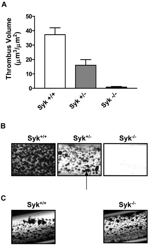 Figure 1. Lack of Syk attenuates arterial thrombus formation ex vivo. (A) Histogram showing the critical role for Syk in mediating thrombosis on type I collagen. (B) Thrombotic deposits formed on collagen-coated capillaries exposed for 2.5 minutes to nonanticoagulated blood from Syk+/+ (n = 9), Syk+/− (n = 10), and radiation chimeras (Syk−/− radiation chimera; n = 7) mice at 871 seconds−1. The black arrow points to platelet-rich thrombi. Quantification was performed on semithin cross section of Epon-embedded thrombotic deposits via computer-assisted morphometry. (C) Photomicrograph of thrombotic deposits formed on tissue factor-coated capillaries at 871 seconds−1 in Syk+/+ and Syk−/− radiation chimera mice.