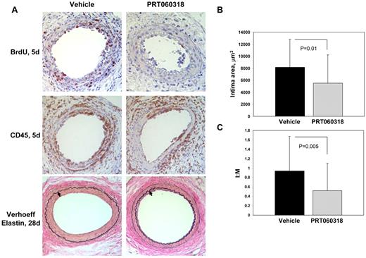 Figure 5. PRT060318 inhibits neointima formation after femoral artery wire injury. (A) Photomicrographs of injured femoral arteries from vehicle control and PRT060318-treated mice after wire injury. Verhoeff elastin staining 28 days after injury. Arrows indicate the internal elastic lamina. Images were captured using a microscope (model DM2000; Leica) and captured with an AxioCam MRc5 camera (Carl Zeiss) interfaced to a computer running Zeiss Axiovision Rel 4.5 software (original magnification, ×20). Immunostaining for CD45 and BrdU 5 days after injury. Quantitative morphometry, including intimal area (B) and intimal area:medial area (I:M) ratio (C), of mouse femoral arteries 28 days after injury.