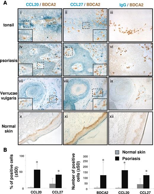 Figure 2. pDCs are in close contact with CCR6 and CCR10 ligands in inflamed epithelia of tonsil, and psoriatic and viral skin lesions. (A) Immunohistochemical stainings on 6-μm acetone fixed sections of tonsils, psoriatic skin, normal skin, and biopsies of verrucae vulgaris showing CCL20 (i,iv,vii,x), CCL27 (ii,v,viii,xi), and control IgG (iii,vi,ix,xii) (green) in epithelial sites together with BDCA-2+ pDCs (brown; original magnification ×20). (Inset) Original magnification ×40;these stainings are representative of 4 independent patients. (B) Positive cells were enumerated in the dermis of psoriatic and normal skin sections (n = 3). Slides were analyzed blind by 2 observers, and positive cells were counted in 5 adjacent fields (original magnification ×40). Results are expressed as the percentage or mean number of positive cells ± SD. *P < .05.