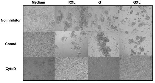 Figure 3. GA101 induces actin polymerization–dependent HA and cell death in CD40-stimulated CLL cells. 3T40L CLL cells were incubated with RXL, G, or GXL, respectively. Cells were preincubated with 100nM concA or 1μM cytoD for 45 minutes before the addition of anti-CD20 mAbs. After 24 hours, HA was assessed by light microscopy. Original magnification, 20×. Data are representative of 10 experiments.