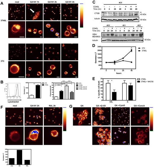 Figure 5. CD40 stimulation sensitizes CLL cells to GA101-induced cell death via a lysosome-dependent mechanism. (A) Confocal microscopy of LysoTracker-labeled unstimulated (bottom panel) and CD40-stimulated CLL cells (top panel) after different time points of treatment with GA101. Shown is the distribution of lysosomes in individual cells visualized in glow-over-under (right: glow-over-under color scale with the highest intensity in blue). Note the increase in both number and activity of lysosomes in CD40-stimulated CLL cells (3T40L medium) compared with unstimulated cells (3T3 medium). After 1 hour of incubation with GA101, CD40-stimulated CLL cells showed clustering of cells (arrow). After 2 hours of incubation with GA101, an increase in LysoTracker signal (blue) was observed in CD40-stimulated CLL cells (top panel), whereas no increase was observed in unstimulated CLL cells. Data shown are representative of 3 individual experiments, each with > 100 cells and identical settings for imaging. Scale bar indicates 5 μm. (B) CD40-stimulated and unstimulated CLL cells were labeled with LysoTracker and analyzed by flow cytometry. Left: representative FACS plot of LysoTracker signal in unstimulated (gray line) and CD40-stimulated CLL cells (black line). Thin black line: unstained control. Middle mean fluorescence intensity (MFI) of LysoTracker in unstimulated and CD40-stimulated CLL cells. Averaged results from 5 CLL patients (mean ± SEM) ***.001 < P < .01 significant difference from control (3T3). Right: Quantification of the number of lysosomes per cell in 3T3, 3T40L, 3T40L + GA 2-hour and 3T40L + GA 6-hour–stimulated CLL cells. Averaged results from 2 independent observers (mean ± SEM) **.001 < P < .01; ***P < .001. (C) Top: Representative Western blot of the 43-kDa procathepsin B (CTSB) of cell lysates from 3T3 and 3T40L CLL cells for 4, 24, or 48 hours. The asterisk (*) marks the position of an aspecific protein band reacting with the antiserum. Tubulin was used as loading control on the same gel. Blot is representative of 4 mutated patients tested. Contrast and brightness were adjusted for optimization. Bottom: in vitro labeling of active GBA in unstimulated and CD40-stimulated CLL cells for different time points (3 different patients). Tubulin was used as loading control on the same samples, run in parallel on a standard SDS-PAGE gel and followed by Western blot. (D) CLL cells were stimulated with 3T3 or 3T40L in a time course (4, 24, and 48 hours), after which time LysoTracker signal was analyzed by flow cytometry. Averaged results from 3 CLL patients are presented as Geomean of LysoTracker signal (mean ± SEM) *.01 < P < .05. (E) CD40-stimulated CLL cells were incubated with RXL or GA101 in the presence or absence of NAC. After 24 hours, cell death was analyzed by measuring MitoTracker signal by flow cytometry. NAC significantly blocked RXL-induced cell death of CD40-stimulated CLL cells, but not GA101-induced cell death. Data are presented as percentage specific cell death (mean ± SEM). Averaged results from 10 independent experiments are shown. *.01 < P < .05. (F) Confocal microscopy of LysoTracker-labeled, CD40-stimulated CLL cells after 2 hours of treatment with GA101 or RXL. Shown is the distribution of lysosomes in individual cells visualized in glow-over-under. GA101 induces an increase in number and activity of lysosomes in contrast to RXL. Scale bar indicates 5 μm. Bar graph shows LysoTracker signal analyzed by flow cytometry. (G) Confocal microscopy of LysoTracker-labeled, CD40-stimulated CLL cells after 2 hours of treatment with GA101 (GA) in the presence or absence of Q-VD, cytoD, or concA. Note that HA and increase in LysoTracker signal were not blocked by Q-VD. An increase in LysoTracker signal was observed in the presence of cytoD, despite the absence of HA. ConcA blocked the GA101-induced increase in LysoTracker signal, but not HA. Scale bar indicates 5 μm.