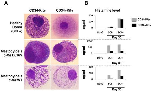 Figure 2. Cytologic aspects (May-Grünwald-Giemsa smears) and histamine production of isolated CD34+/−c-Kit+/− compartments from PB of patients with mastocytosis and healthy controls. (A) Among healthy donors, cultures of both CD34+c-Kit+ and CD34−c-Kit+ cell subsets showed differentiation into mature mast cells in the presence of SCF (top panel), whereas no differentiation was observed in the absence of SCF (data not shown). In patients with proven mastocytosis, bearing either the classic D816V c-Kit mutation or WT c-Kit, similar differentiation into mature mast cells was observed in the presence or absence of SCF (bottom panel). (B) Histamine dosage also supported mast cell differentiation, demonstrating increased histamine levels with or without SCF in both cultured subsets from the patients with mastocytosis, whereas among healthy controls, histamine levels increased only in the presence of SCF.