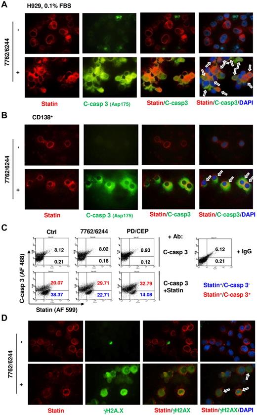 Figure 6. Chk1/MEK1/2 inhibition induces caspase-3 activation and γH2A.X expression in statin-positive (G0/G1) MM cells. (A) H929 cells were incubated in 0.1% FBS medium for 64 hours, and then exposed to 1.5μM AZD6244 for 24 hours, followed by 300nM AZD7762 for an additional 18 hours. (B) Primary CD138+ MM cells isolated from the BM sample of a patient with MM were exposed to 5μM AZD6244 and 250nM AZD7762 for 24 hours. For panels A and B, cells were immunofluorescently stained with Abs against statin (red fluorescence) and cleaved (activated) caspase-3 (green fluorescence) and counterstained with DAPI (blue) after treatment. Images were captured microscopically at 60×/1.40 under oil and then merged as indicated. Arrows indicate cells exhibiting colocalization of statin and activated caspase-3 expression. Results are representative of 3 separate experiments. (C) H929 cells enriched for G0/G1 as described in panel A were exposed to MEK1/2 inhibitors (1.5μM AZD6244 or 1.5μM PD184352) for 24 hours, followed by Chk1 inhibitors (300nM AZD7762 or 300nM CEP3891 for an additional 12 hours. Flow cytometric analysis was used to quantify the percentage of cells coexpressing statin and activated caspase-3 (upper right quadrant). In parallel, untreated cells were incubated with IgG instead of statin or cleaved caspase-3 Abs as a negative control to demonstrate the specificity of the immunostaining. Numbers indicate the percentage of activated caspase-3–negative (blue) or –positive (red) in the statin+ population. Two additional studies yielded equivalent results. (D) Alternatively, G0/G1–enriched H929 cells were treated 1.5μM AZD6244 for 24 hours, followed by 300nM AZD7762 for an additional 6 hours, immunofluorescently stained with Abs against statin (red fluorescence) and γH2A.X (green fluorescence), and then counterstained with DAPI (blue). Images were captured microscopically at 60×/1.40 under oil and then merged as indicated. Arrows indicate cells coexhibiting statin and γH2A.X expression/foci formation.