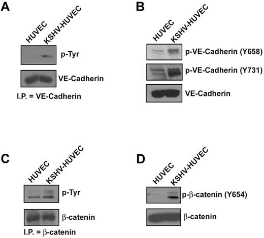 Figure 2. KSHV infection increases VE-cadherin and β-catenin phosphorylation. (A) VE-cadherin was immunoprecipitated with anti–VE-cadherin antibody from lysates of HUVEC and KSHV-HUVEC and analyzed by Western blot using anti-phosphotyrosine antibody (clone 4G10). (B) HUVEC and KSHV-HUVEC lysates were analyzed by Western blot for phosphorylated forms of VE-cadherin using antibodies that specifically recognize VE-cadherin phosphorylated at Tyr-658 (Y658) and Tyr-731 (Y731). Total VE-cadherin was used as a loading control. (C) β-catenin was immunoprecipitated with anti–β-catenin antibody from lysates of HUVEC and KSHV-HUVEC, and analyzed by Western blot using anti-phosphotyrosine antibody (clone 4G10). (D) HUVEC and KSHV-HUVEC lysates were analyzed by Western blot for phosphorylated forms of β-catenin using antibodies that specifically recognize β-catenin phosphorylated at Tyr-654 (Y654). Total β-catenin was used as a loading control.