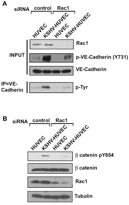 Figure 3. Rac1 is necessary for KSHV-induced VE-cadherin and β-catenin phosphorylation. (A) HUVEC and KSHV-HUVEC were transfected for 48 hours with control siRNA or siRNA targeting Rac1 and then lysed. VE-cadherin was immunoprecipitated with anti–VE-cadherin antibody and analyzed by Western blot using anti-phosphotyrosine antibody (clone 4G10). The phosphorylated forms of VE-cadherin were analyzed by immunoblotting using antibodies that specifically recognize VE-cadherin phosphorylated at Tyr-731 (Y731). Total VE-cadherin was used as a loading control. (B) HUVEC and KSHV-HUVEC were transfected for 48 hours with control siRNA or siRNA targeting Rac1 and then lysed. Lysates were analyzed by Western blot for phosphorylated forms of β-catenin using antibodies that specifically recognize β-catenin phosphorylated at Tyr-654 (Y654). Total β-catenin was used as a loading control.