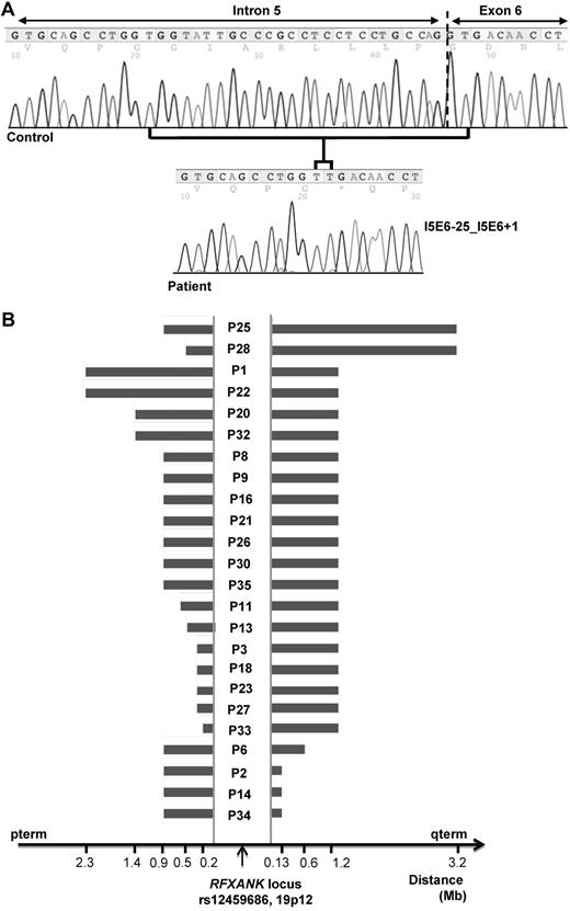 Figure 1. Genetic analysis. (A) RFXANK mutation. Normal nucleotide sequence of the intron 5/exon 6 boundary of the RFXANK gene and the sequence from a patient with the homozygous 26-bp deletion I5E6-25_I5E6 + 1 (also known as 752delG-25). (B) Haplotype common to 24 unrelated patients with the homozygous 26-bp deletion in the RFXANK gene. An analysis of SNP Array 250 K data showed that patients carrying the I5E6-25_I5E6 + 1 deletion had a common homozygous haplotype around the RFXANK locus.