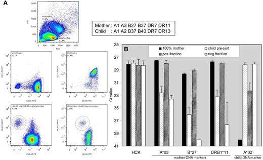 Figure 4. FACS-based separation of maternal cells from umbilical cord blood. FACS-sorted cells, acquired with 2 HLA mAbs (mAb SN607D8-PE against child's HLA-A2 and mAb OK2F3-biotine against mother's HLA-A3), were processed for qPCR analysis. (A) In both the lymphocyte (CD14−CD45+) and monocyte (CD14+CD45+) population (2 middle plots), gated from the forward-sideward scatter (top plot), microchimeric cells could be detected, which are HLA-A3pos and HLA-A2neg (2 bottom plots). (B) Reference gene HCK, maternal DNA markers HLA-A*03, HLA-B*27 and HLA-DRB1*11, and child DNA marker HLA-A*02 were analyzed in quadruplicate with qPCR on an equivalent of 100 unsorted and sorted PBMCs.