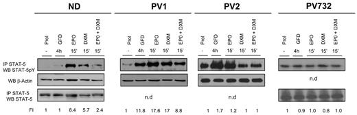 Figure 3. Constitutive phosphorylation and nuclear translocation of STAT-5 in EBs generated ex vivo from PV patients. Levels of STAT-5 phosphorylation in cell extracts of EBs obtained in HEMA culture (Prol) from 1 ND and 3 PV patients and in cultures deprived of growth factor for 4 hours (GFD) and then treated with erythropoietin (EPO; 3 U/mL) and dexamethasone (DXM; 10−6M), alone or in combination, as indicated. STAT-5 phosphorylation was analyzed by WB of cell extracts immunoprecipitated (IP) with anti–STAT-5 antibody. The cell lysates were then analyzed by WB for β-actin and/or STAT-5 as quantitative control. The intensity of the signal was quantified by densitometry and expressed as a ratio (FI indicates fold increase) with the signal from cells in Prol. Similar data on STAT-5 phosphorylation of EBs from 10 additional NDs were reported previously.20