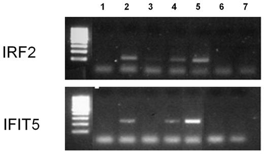 Figure 4. IRF-1 ChIP assay. Day 6 MDDCs were treated with HIV-1BaL or IFNγ for 48 hours. A ChIP assay was then performed with an IRF-1 antibody, and qPCR primers were directed toward IRF-2 or IFIT5 promoter sequences to determine IRF-1 binding. (Lane 1) HIV-1–treated MDDCs no IRF-1 antibody, (lane 2) HIV-1–treated MDDCs plus IRF-1 antibody, (lane 3) IFNγ-treated MDDCs no IRF-1 antibody, (lane 4) IFNγ-treated MDDCs plus IRF-1 antibody, (lane 5) cell input DNA, (lane 6) PCR negative no DNA control, and (lane 7) ChIP reagents only negative control.