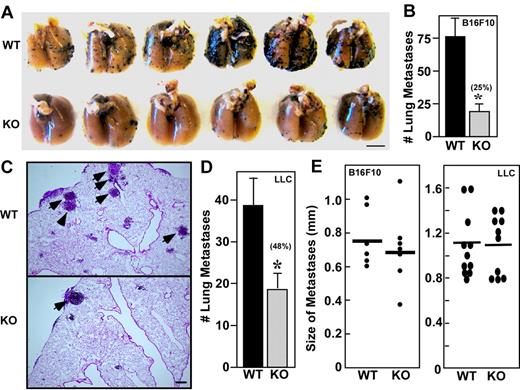 Figure 1. Host CD151 affects experimental pulmonary metastasis. (A) Representative photograph of pulmonary metastatic foci produced 14 days after intravenous injection of B16F10 cells. Scale bar indicates 5 mm. (B) Numbers of experimental pulmonary B16F10 metastases in left lobes. (C) Representative lung H&E sections of metastases from wild-type (WT) and CD151-null (KO) mice. Arrows point to metastatic foci. Scale bar = 200 μm. (D) Numbers of experimental pulmonary metastasis formed by LLC cells (n = 5). (E) Size distributions of B16F10 and LLC metastatic foci. Data are representative of 3 independent experiments with similar results. Error bars indicate means ± SEM.