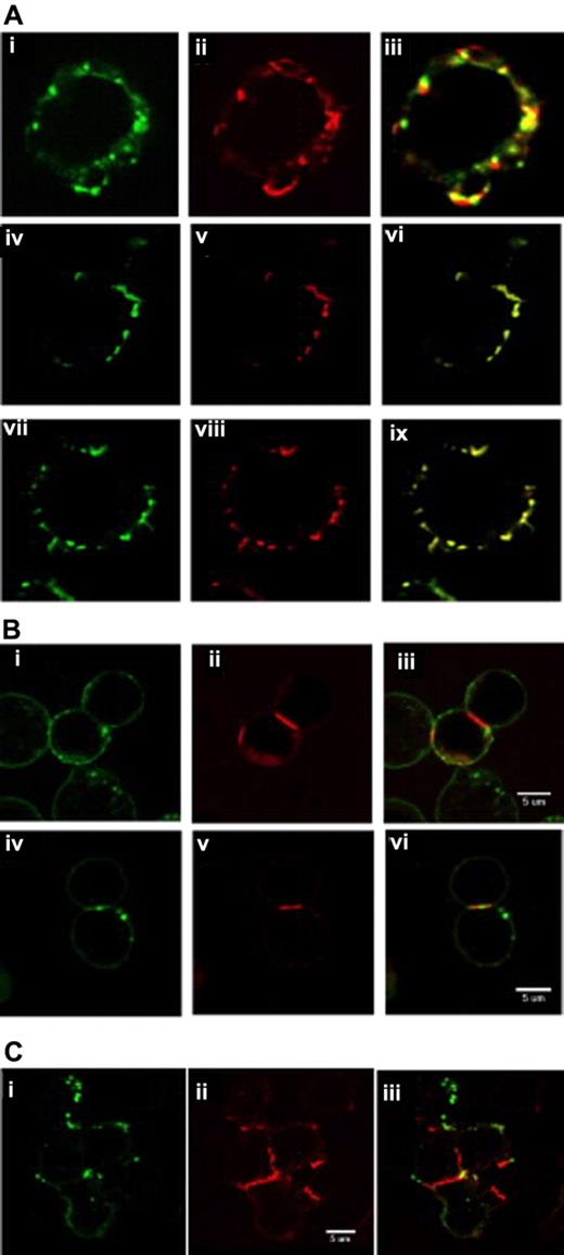 Figure 6. Confocal microscopy showing membrane compartmentalization of rituximab-associated versus GA101-associated CD20 complexes. (A) After ≥ 1 hour of incubation at 37°C with 5 μg/mL of dye-labeled antibodies, only partial colocalization of rituximab (red) and GA101 (green) was seen in isolated Z138 cells (panels i-iii), whereas control stainings with differently labeled versions of the same antibody resulted in each case in 100% colocalization (panels iv-vi for GA101 and panels vii-ix for rituximab). (B) Different membrane compartmentalization of rituximab (green) and GA101 (red) was also observed in the Burkitt lymphoma cell line Ramos (panels i-iii) and in freshly isolated normal B cells (panels iv-vi). (C) After homotypic aggregation of Z138 cells, rituximab (green) remained concentrated in large membrane spots, whereas GA101 (red) accumulated in areas of cell-cell contact, resulting in almost complete separation of the 2 labels (panels i-iii).