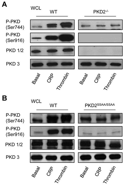 Figure 2. PKD expression and activation profile in platelets. Washed platelets from WT, PKD2−/− (A), or PKD2SSAA/SSAA (B) mice (2 × 108/mL) were incubated with CRP (5 μg/mL) or thrombin (1 unit/mL) for 1 minute under stirring conditions. Platelets were then solubilized in Laemmli sample buffer and whole cell lysates were subjected to SDS-PAGE, transferred to PVDF membrane, and immunoblotted with PKD1/2, PKD3, P-PKD (Ser916), or P-PKD (Ser744) antibodies. Data shown are representative of 3 independent experiments.