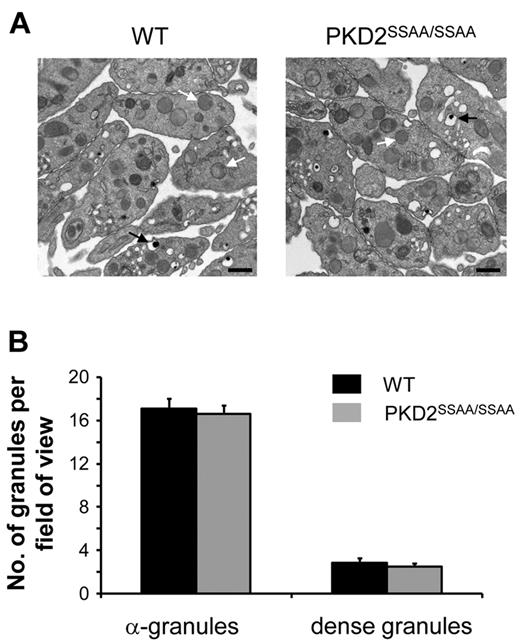 Figure 4. Biogenesis of dense and α-granules is not regulated by PKD2 activity. Washed platelets from WT or PKD2SSAA/SSAA mice were examined by transmission electron microscopy, and the number of dense granules (black arrows) and α-granules (white arrows) was quantified as described in “Electron microscopy.” (A) Images of platelets from WT (left panel) or PKD2SSAA/SSAA (right panel) mice are representative of 3 independent experiments. Original magnification was 19 000×, and the bar represents 500 nm. (B) Dense and α-granules were counted per fields of view (25-30 fields of view per section, 3 sections per preparation on average) and are shown as means ± SEM, n = 3.