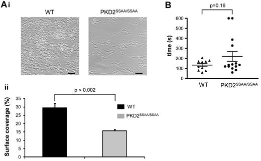 Figure 6. PKD2SSAA/SSAA mice display reduced thrombus formation in vitro but have normal tail-bleeding responses. Heparin/PPACK-anticoagulated blood from WT or PKD2SSAA/SSAA mice was passed over collagen (shear rate 1000/s). (Ai) Representative phase-contrast images after 4 minutes of flow. Scale bars represent 20 μm. (ii) Platelet coverage of coated surfaces was quantified and the mean surface area ± standard error of the mean is shown for 3 independent experiments. *P < .05. (B) Mice were anesthetized and a transverse incision made with a scalpel at a position where the diameter of the tail was 2.25-2.5 mm. The tail was immersed in normal saline (37°C) in a hand-held test tube. The time from incision to cessation of bleeding was recorded, and mean times are shown as horizontal bars. No significant difference was seen comparing WT mice with PKD2SSAA/SSAA mice (n = 10-14).