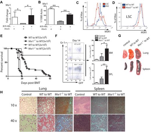 Figure 1. Msr1 deletion accelerates CML development. (A) Expression of the Msr1 gene was compared among non–BCR-ABL–expressing Lin−Sca-1+c-Kit+ cells, BCR-ABL-expressing WT LSCs and BCR-ABL-expressing Alox5−/− LSCs. Msr1 expression was down-regulated by BCR-ABL and restored on Alox5 deletion in LSCs. (B) Quantitative real-time PCR analysis of non–BCR-ABL–expressing Lin−Sca-1+c-Kit+ cells, BCR-ABL–expressing WT LSCs and BCR-ABL–expressing Alox5−/− LSCs. Expression of the Msr1 gene was significantly down-regulated by BCR-ABL and partially rescued after Alox5 deletion in LSCs compared with WT LSCs by RT-PCR. Mean value (± SD) for each group is shown (**P < .01). (C) FACS analysis showed that MSR1 protein was down-regulated by BCR-ABL in LSCs compared with GFP−Lin−c-Kit+Sca-1+ cells that did not express BCR-ABL. (D) FACS analysis showed that MSR1 protein was up-regulated by Alox5 deletion in LSCs compared with WT LSCs. (E) Kaplan-Meier survival curves for recipients of BCR-ABL–transduced bone marrow cells from WT or Msr1−/− donor mice. All recipients of BCR-ABL–transduced bone marrow cells from Msr1−/− donor mice developed CML and died within 3 weeks post bone marrow transplantation, whereas recipients of BCR-ABL–transduced bone marrow cells from WT donor mice survived longer. (F) FACS analysis showed a higher percentage of GFP+Gr-1+ cells in the bone marrow and spleens of recipients of BCR-ABL–transduced bone marrow cells from Msr1−/− than WT donor mice (**P < .01). (G) Gross pathology and (H) H&E staining of the lungs and spleens showed severe lung hemorrhages and splenomegaly in recipients of BCR-ABL–transduced bone marrow cells from Msr1−/− donor mice. Recipient of pMSCV-GFP–transduced bone marrow cells was shown as a control.
