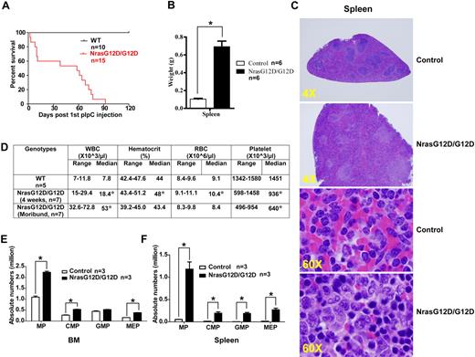 Figure 4. All the Nras G12D/G12D mice die with a severe myeloproliferative disease. After pI-pC injections, control and Nras G12D/G12D mice were kept for an extended period of time until Nras G12D/G12D mice reached a moribund stage. (A) Kaplan-Meier comparative survival analysis of control and Nras G12D/G12D mice. Cumulative survival was plotted against days after the first pI-pC injection. (B) Splenomegaly in Nras G12D/G12D mice. Results are presented as averages of spleen weights + SDs. (C) Representative histologic H&E sections from spleen show an extensive infiltration of myelomonocytic cells and extramedullary hematopoiesis in Nras G12D/G12D mice. (D) Complete blood count was performed on peripheral blood samples drawn from control and Nras G12D/G12D mice. *P < .05. (E-F) Quantitative analysis of myeloid progenitor (MP) compartment in bone marrow (E) or spleen (F) of control and moribund Nras G12D/G12D mice as described in Figure 3. Results are presented as averages + SDs. *P < .05.