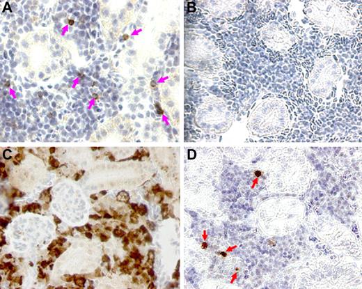 Figure 6. Immunohistochemical staining of sections of zebrafish kidney with anti-GFP Ab. Staining was performed on paraffin-embedded kidney sections using a 1:1500 dilution of anti-GFP Ab and peroxidase-conjugated secondary Ab. Brown-staining cells were observed in panels A, C, and D. (A) In donor Tg(CD41:GFP) kidney, representative CD41-GFP+ cells are indicated by pink arrows. (B) In wild-type untransplanted fish, there was no staining detected. (C) Irradiated fish that were transplanted with 0.5 × 106 β-actin:GFP+ cells from Tg(β-actin:GFP) WKM showed engrafted cells of multiple lineages throughout the renal tubules and interstitium, as exhibited by brown signals galore in the kidney section. (D) In transplanted fish that received 103 flow-sorted CD41-GFPlo cells, engrafted cells were marked by red arrows in the hematopoietic cell portion of the recipient kidney.