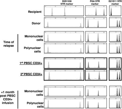 Figure 1. Chimerim analysis using STR (short tandem repeat) multiplex polymerase chain reaction. Genomic DNA, extracted from mononuclear, polynuclear, or PBSC CD34+ cells, was used as a template for amplification of 16 polymorphic STR markers (AmpFlSTR Profiler Plus Kit; Applied Biosystems). Full donor chimerism was detected in all informative STR markers (9 of 16) at time of relapse (January 2010), after salvage chemothery in both PBSC CD34+ collections (July and August 2010) and 1 month after PBSC infusion (October 2010). Three representative STR markers (D2S1338, FGA, and D21S11) were depicted.