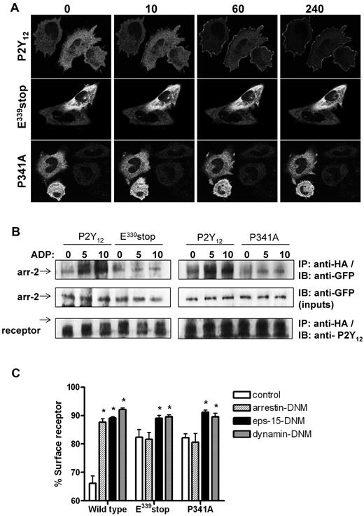 Figure 4. An intact PDZ-binding ligand is required for arrestin- but not clathrin-dependent internalization of the P2Y12 receptor. (A) Cells stably expressing receptor constructs were transfected with arrestin-2–GFP. Before imaging, coverslips were mounted in an imaging chamber at 37°C. The initial diffuse cytoplasmic distribution of arrestin-2–GFP is shown before agonist stimulation (0 second). ADP (10μM) was added, and the redistribution of arrestin-2 was monitored in real time. The images shown were collected at 10, 60, and 240 seconds after agonist addition. Data shown are representative of 3 independent experiments. (B) Cells stably expressing receptor construct were transiently transfected with arrestin-2–GFP. Cells were stimulated with ADP (10μM; 5 and 10 minutes). Receptor was immunoprecipitated from cell lysates with the use of an anti-HA Ab (HA-11), and arrestin-2 association was assessed with an anti-GFP Ab. Equal loading of arrestin-2–GFP was confirmed in cell lysates taken before receptor immunoprecipitation. As shown arrestin-2/receptor association was only found in cells expressing the full-length P2Y12 purinergic receptor. Like E339stop and the P341A variant, T320stop did not associate with arrestin (data not shown). Data shown are representative of 3 independent experiments. (C) Receptor-expressing cells were transiently transfected with DNM forms of arrestin-2 (319-418; arrestin-DNM), eps-15 (E95-295; eps-15–DNM), dynamin (K44A; dynamin-DNM), or vector (pcDNA3) alone. Cells were subsequently challenged with ADP (10μM; 30 minutes), and surface receptor loss was assessed by ELISA. The data represent means ± SEMs of 7 independent experiments. *P < .05 compared with respective pcDNA3 vector transfected controls (Mann-Whitney U test).