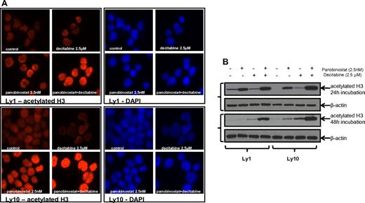 Figure 5. Histone acetylation in DLBCL lines after treatment with panobinostat and decitabine. (A) Immunofluorescence analysis of H3 acetylation in Ly1 and Ly10 lines after treatment with panobinostat and decitabine alone or their combination for 24 hours. The same exposure times reveal increased H3 acetylation in the combination group. (B) Western blot analysis of the H3 acetylation after treatment with panobinostat and decitabine alone or their combination in Ly1 and Ly10 lines at 2 time points (24 and 48 hours).