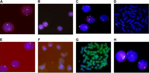 Figure 3. Results of FISH of HCs and MSCs. FISH of HCs and MSCs from a patient (N0214) with s-AML M6 (A-D). (A) FISH image with probes LSI EGR1 (5q31, red)/D5S23 (5p15.2, green) showing del(5q) in interphase nuclei from leukemic blasts. (B) FISH image of MSCs with the same probes demonstrates 2 signals for chromosome 5. (C) FISH image with probes D7S740 (7q22, green)/(7q35, red) demonstrates del(7)(q22) in MSCs and 2 signals for corresponding chromosomes in HCs (D). FISH of HCs and MSCs of a patient (N1150) with s-AML M4 (E-J): (E) FISH image with probes LSI WBS (7q11, red) and LSI D7S522 (7q31, green) demonstrates monosomy 7 in HCs. (F) MSCs shows 2 signals for chromosome 7. (G) MSC metaphase with 1 split signal from MLL DC probe confirms del(11)(q23). (H) Interphase nuclei of HCs demonstrate 2 normal chromosomes 11.