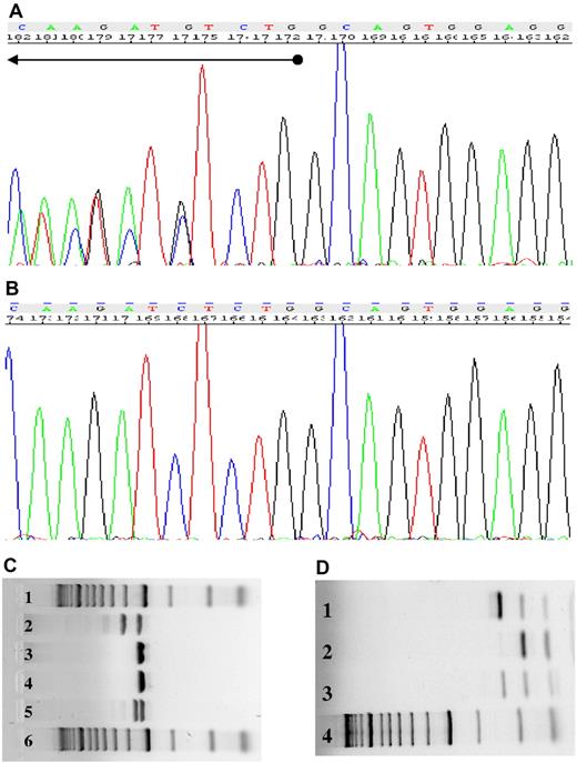 Figure 5. Absence of FLT3 and NPM1 mutations in MSCs. (A) The DNA sequence derived from the HCs of patient 1093 demonstrates mutation of the NPM1 gene. (B) MSCs of patient 1093 display the wild-type NPM1 gene. (C) The FLT3-ITD mutation was detected in the HCs of patient 0757 (lane 2), but not in the MSCs (lane 3). Lane 4 displays the negative control, lane 5 the positive control, and lanes 1 and 6 the size standards. (D) The FLT3-D835 mutation was observed in the HCs of patient 0281 (lane 1), but not in the MSCs (lane 2). Lanes 3 and 4 present the positive control and size standard, respectively.