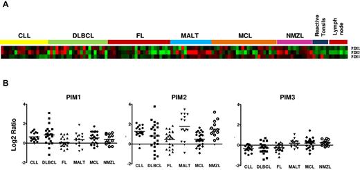 Figure 1. PIM genes are differentially expressed in B-cell NHL cases. (A) Heatmap showing PIM kinase gene expression of the complete series of 114 NHL patients and 14 control tissues. Data were normalized with respect to reactive lymph node and tonsils. (B) PIM expression in various B-cell lymphoma types. Gene expression data were normalized with respect to lymph node expression. Log 2 ratios are shown, and the mean of the series is included for each lymphoma type. There is an increase in the expression of PIM1 and PIM2 in subsets of most lymphoma types.