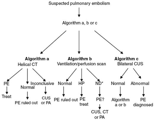 Figure 1. Proposed algorithm in pregnant women with suspected PE. CUS indicates compression ultrasound; PA, pulmonary angiography; HP, high probability; and ND, nondiagnostic. Adapted from Nijkeuter et al.11