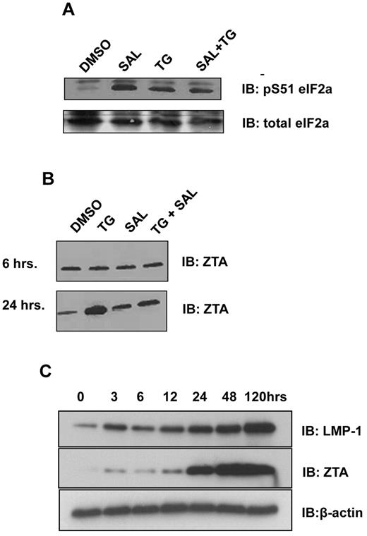 Figure 1. ER stress induces phosphorylation of eIF2α and expression of ZTA and LMP1. (A) SAL and ER stress result in increased levels of eIF2α S51 phosphorylation. LCLs were treated with SAL (40μM for 24 hours), TG (50μM for 6 hours), or SAL and TG as described. Western blot analysis for total eIF2α and pS51 eIF2α were performed 24 hours after treatment. (B) ER stress induces ZTA expression in LCLs. LCLs were treated with TG, SAL, or TG + SAL as described and at 6 or 24 hours after treatment, the cells were lysed in 1× RIPA buffer. Equal amounts of protein were analyzed by Western blot for ZTA. (C) Time-course experiment of ZTA and LMP1 protein expression after the induction of ER stress. LCLs were treated with TG and cells were lysed at the indicated times after TG treatment in 1× RIPA buffer. Equal amounts of protein were analyzed by Western blot for ZTA and LMP1.
