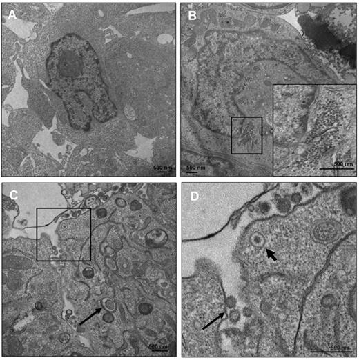 Figure 6. ER stress induces virus production. LCLs were treated with DMSO (A) or TG (B-D) and at 5 days after treatment the cells were processed for EM. (B) Accumulation of nucleocapsid cores near the nuclear membrane with an inset of a higher magnification of the nucleocapsid cores. (C) EBV-enveloped virus transport and budding at the plasma membrane. Arrow indicates the occurrence of a double-membrane vesicle, a hallmark of autophagy. (D) Higher magnification of the boxed area in panel C. Thick arrow shows an enveloped virion being transported to the plasma membrane and the thin arrow shows a budding virus.